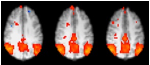 BOLD FMRI